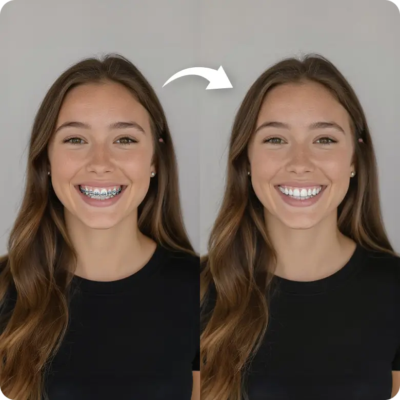 instantly remove braces from a photo without any manual editing using ai tools.