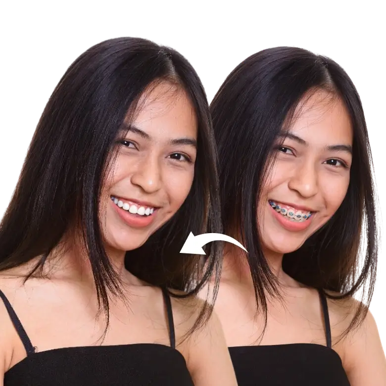 smile edited with no visible gaps or distortion after removing braces from the image.