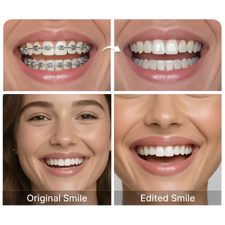 try out similar ai tools like teeth whitening, lip fuller, and other facial enhancements.
