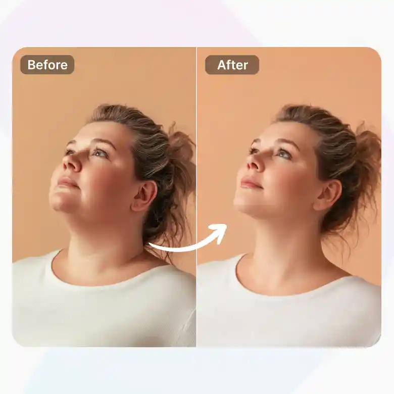 woman looking up using face reshape ai to remove double chin from photo naturally.