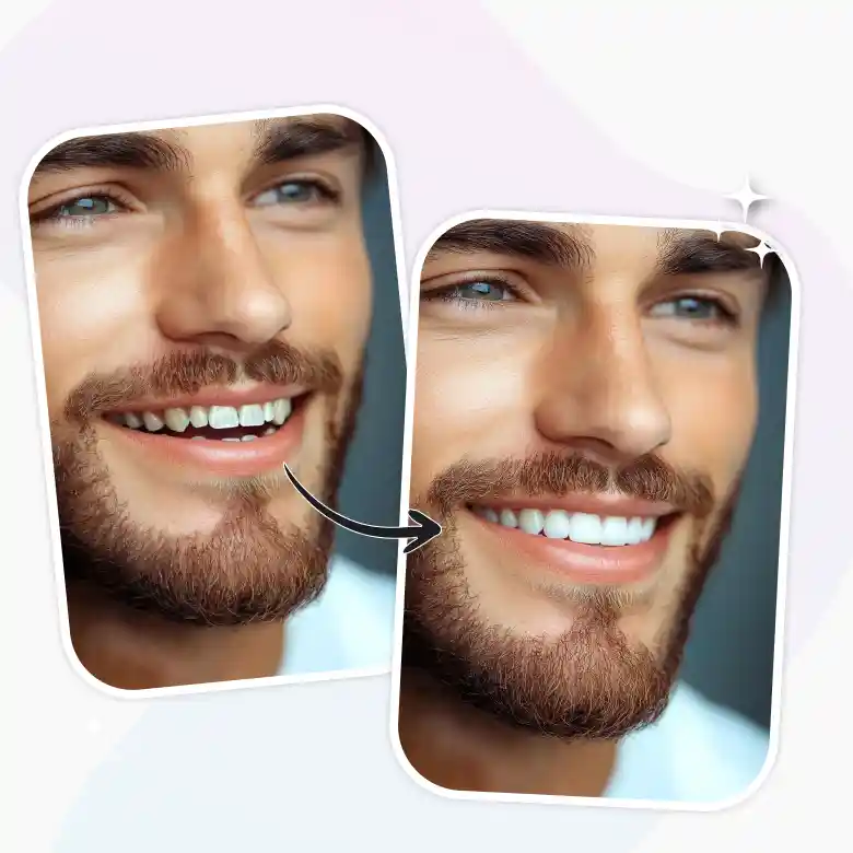 man with imperfect teeth transformed using Straight Teeth Filter for natural teeth alignment.