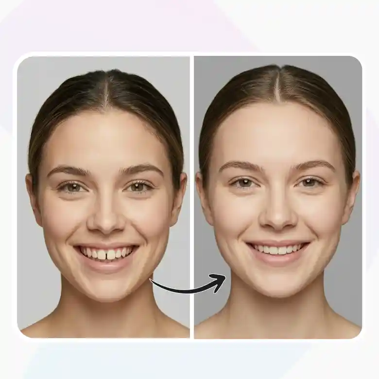 invisalign simulation using teeth alignment photo editor to preview a straighter smile.
