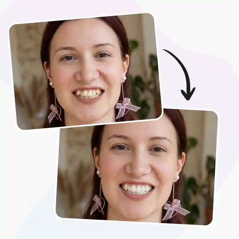 girl using teeth whitening photo editor for straight clear and brighter teeth.
