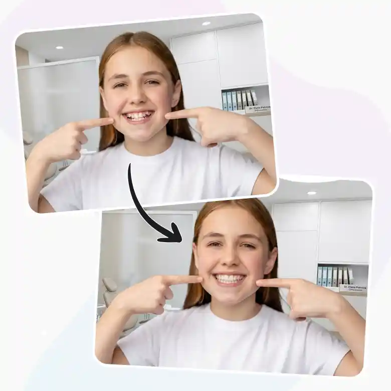 girl smiling confidently with perfect teeth filter for a clean naturally aligned smile.