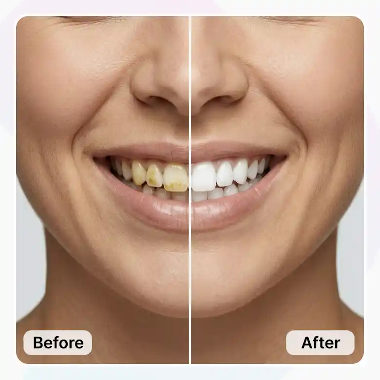 close up teeth before after using photo editor teeth fixer online free for a cleaner smile.