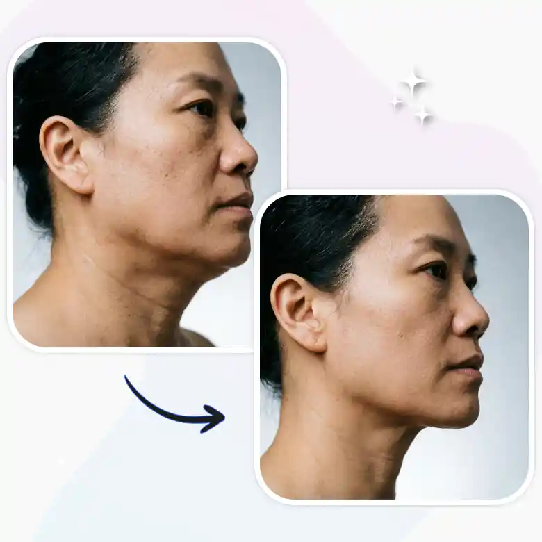 side angle portrait using jawline editor to get rid of double chin in photo naturally.